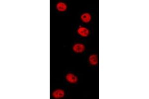 ABIN6277154 staining  HT29 cells by IF/ICC. (IRF3 anticorps  (C-Term))