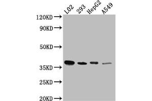 Western Blot Positive WB detected in: L02 whole cell lysate, HEK293 whole cell lysate, HepG2 whole cell lysate, A549 whole cell lysate All lanes: LRG1 antibody at 1:1000 Secondary Goat polyclonal to rabbit IgG at 1/50000 dilution Predicted band size: 39 kDa Observed band size: 39 kDa (Recombinant LRG1 anticorps)