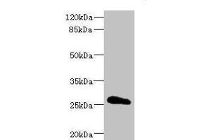 Western blot All lanes: CLDN18 antibody IgG at 3. (Claudin 18 anticorps  (AA 20-80))
