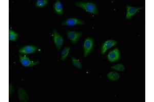 Immunofluorescence staining of A549 cells with ABIN7175225 at 1:50, counter-stained with DAPI.
