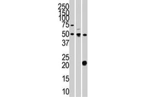 The STYK1 polyclonal antibody  is used in Western blot to detect STYK1 in 293 (left) , CEM (center) , and mouse kidney (right) cell line and tissue lysates. (STYK1 anticorps  (N-Term))