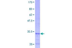 Image no. 1 for Cytochrome C Oxidase Subunit VIIc (COX7C) (AA 1-63) protein (GST tag) (ABIN1350158)