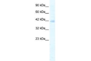 WB Suggested Anti-KCTD18 Antibody Titration:  5. (KCTD18 anticorps  (N-Term))
