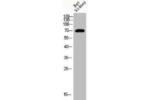 Western Blot analysis of RAT-kidney cells using Acetyl-HSP70 (K246) Polyclonal Antibody