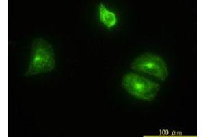 Image no. 4 for anti-Clathrin, Light Chain B (CLTB) (AA 1-212) antibody (ABIN598618) (CLTB anticorps  (AA 1-212))