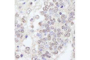 Immunohistochemistry (IHC) image for anti-Tripartite Motif Containing 33 (TRIM33) (C-Term) antibody (ABIN7448843) (TRIM33 anticorps  (C-Term))