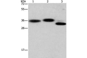 Western Blot analysis of Hela cell, Mouse brain and heart tissue using CAPZA2 Polyclonal Antibody at dilution of 1:650 (CAPZA2 anticorps)