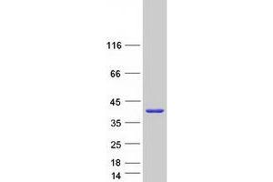 Validation with Western Blot (SULT1A4 Protein (Transcript Variant 1) (Myc-DYKDDDDK Tag))