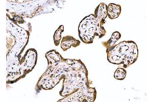 IHC analysis of MRP3/ABCC3 using anti-MRP3/ABCC3 antibody (ABIN7600647).