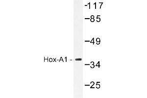Image no. 1 for anti-Homeobox A1 (HOXA1) antibody (ABIN272197) (HOXA1 anticorps)