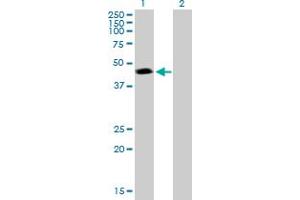 Western Blot analysis of PSMC3 expression in transfected 293T cell line by PSMC3 MaxPab polyclonal antibody. (PSMC3 anticorps  (AA 1-439))