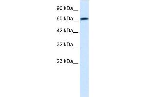 WB Suggested Anti-PSIP1 Antibody Titration:  0. (PSIP1 anticorps  (Middle Region))