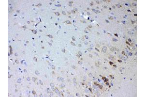 IHC analysis of IL15RA using anti-IL15RA antibody .
