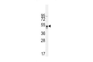 Western blot analysis in A549 cell line lysates (35ug/lane).