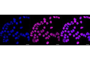 anti-Polypyrimidine Tract Binding Protein 2 (PTBP2) antibody