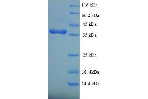 SDS-PAGE (SDS) image for Dual Specificity Phosphatase 26 (DUSP26) (AA 1-211), (full length) protein (His-SUMO Tag) (ABIN5711773) (DUSP26 Protein (AA 1-211, full length) (His-SUMO Tag))