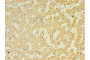 Immunohistochemistry of paraffin-embedded human liver tissue using ABIN7174641 at dilution of 1:100 (UGT2B4 anticorps  (AA 281-481))