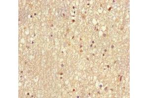 Immunohistochemistry of paraffin-embedded human brain tissue using ABIN7174494 at dilution of 1:100 (UBE2V2 anticorps  (AA 2-145))
