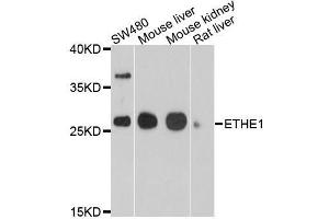 Western blot analysis of extracts of various cell lines, using ETHE1 antibody. (ETHE1 anticorps  (AA 8-245))