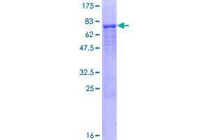 Image no. 1 for Allantoicase (ALLC) (AA 1-409) protein (GST tag) (ABIN1344900)