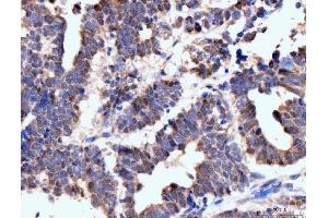 IHC analysis of Neurofibromin/NF1 using anti-Neurofibromin/NF1 antibody (ABIN7600196).