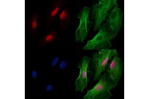 ABIN6261092 and ABIN6277988 staining  cells by IF/ICC. (CTNNBL1 anticorps  (N-Term))