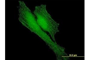Immunofluorescence of monoclonal antibody to BARD1 on HeLa cell.