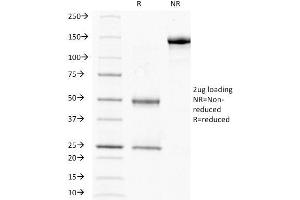 SDS-PAGE Analysis Purified HCG-beta Mouse Monoclonal Antibody (HCGb/211). (CGB anticorps)