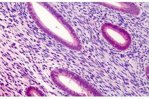 Human Uterus: Formalin-Fixed, Paraffin-Embedded (FFPE) (ATG16L1 anticorps  (Internal Region))