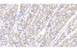 Detection of TNS1 in Human Stomach Tissue using Polyclonal Antibody to Tensin 1 (TNS1) (Tensin 1 anticorps  (AA 4-307))