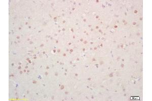 Formalin-fixed and paraffin embedded rat brain labeled with Rabbit Anti Phosphoserine/threonine/tyrosine Polyclonal Antibody, Unconjugated (ABIN1385069) at 1:200 followed by conjugation to the secondary antibody and DAB staining (Phosphoserine/Phosphothreonine/Phosphotyrosine (phosphorylated) anticorps)