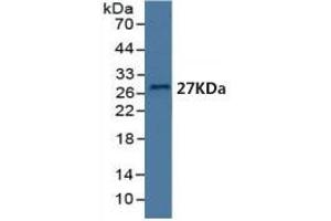 Mouse Capture antibody from the kit in WB with Positive Control: Human serum.