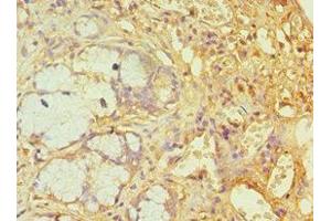 Immunohistochemistry of paraffin-embedded human gallbladder tissue using ABIN7144783 at dilution of 1:100 (Ataxin 1 anticorps  (AA 586-815))