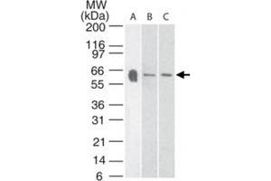 Western blot analysis of Htr3a in A) human, B) mouse and C) rat brain tissue lysate using Htr3a polyclonal antibody  at 3 ug/mL . (Serotonin Receptor 3A anticorps  (AA 21-36))