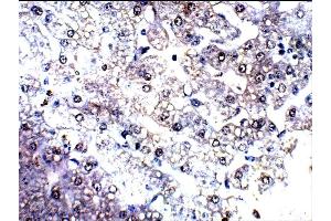 Detecting C4a in Baboon Kidney using ABIN2749472