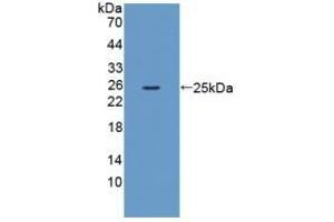 Detection of Recombinant XCR1, Mouse using Polyclonal Antibody to Chemokine C-Motif Receptor 1 (XCR1) (XCR1 anticorps  (AA 244-322))