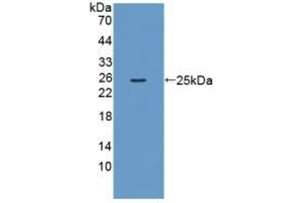 XCR1 anticorps  (AA 244-322)