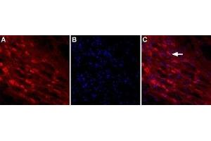 Expression of NLGN2 in rat brain - Immunnohistochemical staining of rat reticular thalamic nucleus using Anti-Neuroligin 2 (extracellular) Antibody (ABIN7043362, ABIN7044682 and ABIN7044683).
