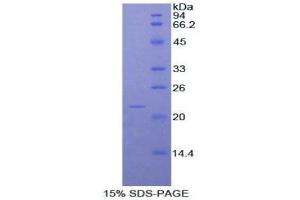 SDS-PAGE (SDS) image for Nitric Oxide Synthase 2, Inducible (NOS2) (AA 518-694) protein (His tag) (ABIN1877324)