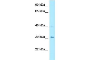 WB Suggested Anti-CA7 Antibody Titration: 1. (CA7 anticorps  (Middle Region))