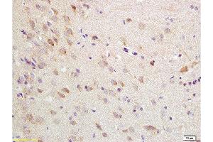 Formalin-fixed and paraffin embedded rat brain tissue labeled with Anti-ChRM1/Acetylcholine receptor(M1) Polyclonal Antibody, Unconjugated  at 1:200 followed by conjugation to the secondary antibody, (SP-0023), and DAB staining (CHRM1 anticorps  (AA 321-420))