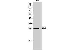 Western Blotting (WB) image for anti-Interleukin-27 subunit beta (IL-27b) (Internal Region) antibody (ABIN3181482) (EBI3 anticorps  (Internal Region))