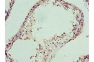Immunohistochemistry of paraffin-embedded human testis tissue using ABIN7164296 at dilution of 1:100