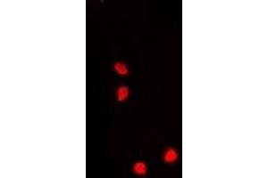 Immunofluorescent analysis of Nucleostemin staining in A549 cells.