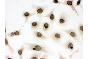 IHC analysis of Lamin B1 using anti-Lamin B1 antibody .