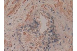 Detection of CD200 in Human Prostate Tissue using Polyclonal Antibody to Cluster Of Differentiation 200 (CD200)