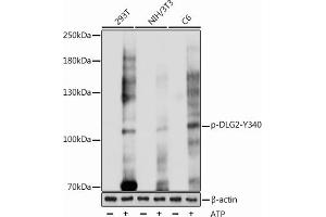 Western blot analysis of extracts of various cell lines, using Phospho-PSD93/chapsyn-110/DLG2-Y340 antibody (ABIN7266792) at 1:1000 dilution.
