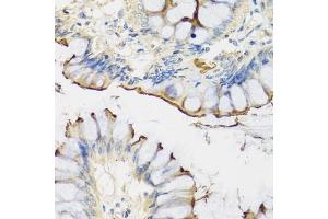 Immunohistochemistry of paraffin-embedded human colon using CRTAP antibody (ABIN1679366, ABIN3018913, ABIN3018914 and ABIN6220627) at dilution of 1:100 (40x lens). (CRTAP anticorps  (AA 20-240))
