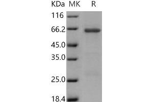 Western Blotting (WB) image for Tribbles Homolog 3 (Drosophila) (TRIB3) protein (GST tag) (ABIN7198334)