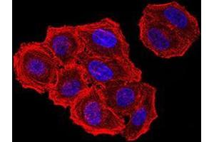 Immunofluorescence analysis of Hela cells using ZFP91 mouse mAb.